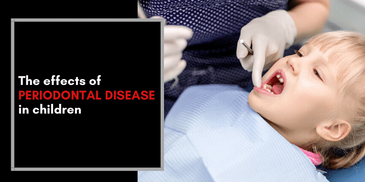 The Effects Of Periodontal Disease In Children