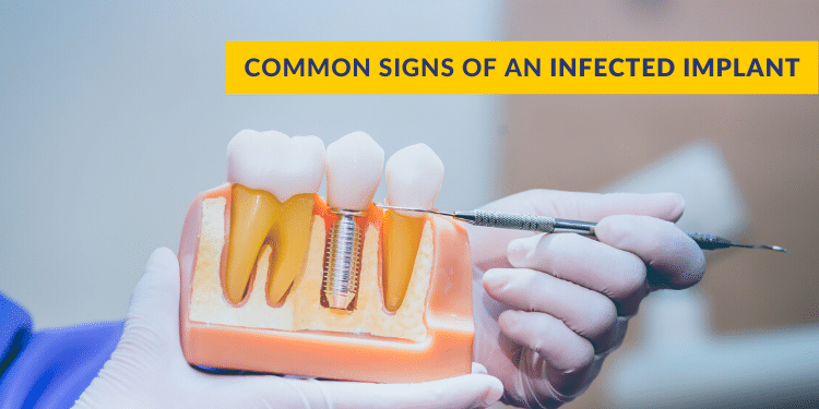 Common signs of an infected implant