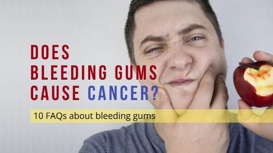 Does bleeding gums cause cancer? 10 New FAQs