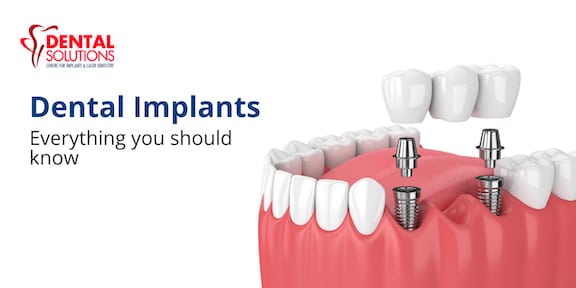 Dental Implants – Types, Advantages, Procedure, Cost, and Risks