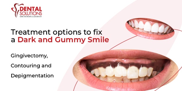 Dark and gummy smile treatment  – 3 effective options that will help