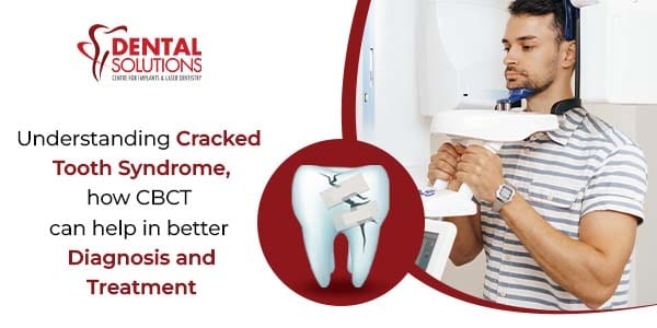 Cracked tooth syndrome: how CBCT can help in better diagnosis and treatment