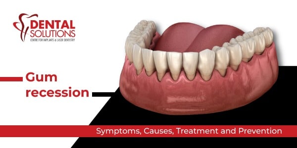 gum recession symptoms causes treatment and prevention
