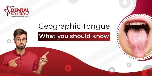 geographic tongue causes